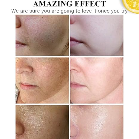 🌿✨ PIEL RADIANTE AL INSTANTE – HIDRATA, ACLARA Y RENUEVA CON VITAMINA C 🍊💧
