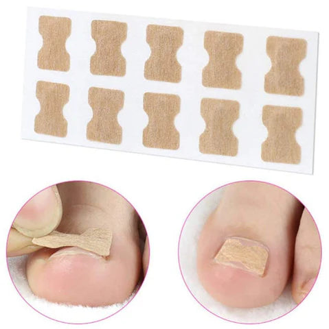 💅✨ Parches para Uñas Encarnadas – Protección y Cuidado para tus Pies 👣✅.