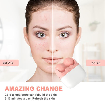 💆‍♀️✨ REVOLUCIONA TU BELLEZA CON EL ICE ROLLER 3D – RELAJA, REJUVENECE Y RESPLANDECE 💖❄️